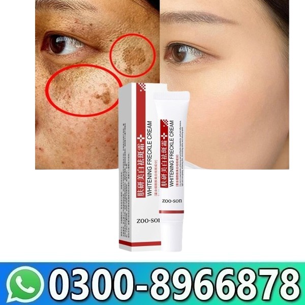 Whitening Face Dark Spot Remover Corrector Cream Price In Pakistan