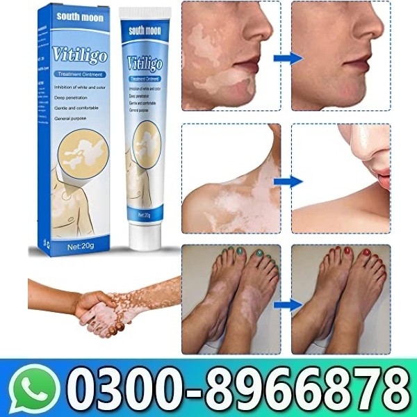 South Moon Vitiligo Treatment Cream In Pakistan