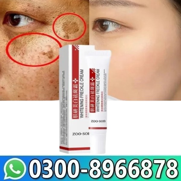 Zooson Freckle Cream In Pakistan